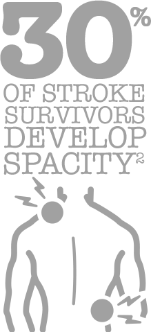 30% of stroke survivors develop spasticity